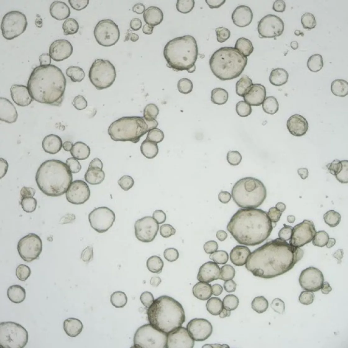 Gastric Cancer Organoid_main