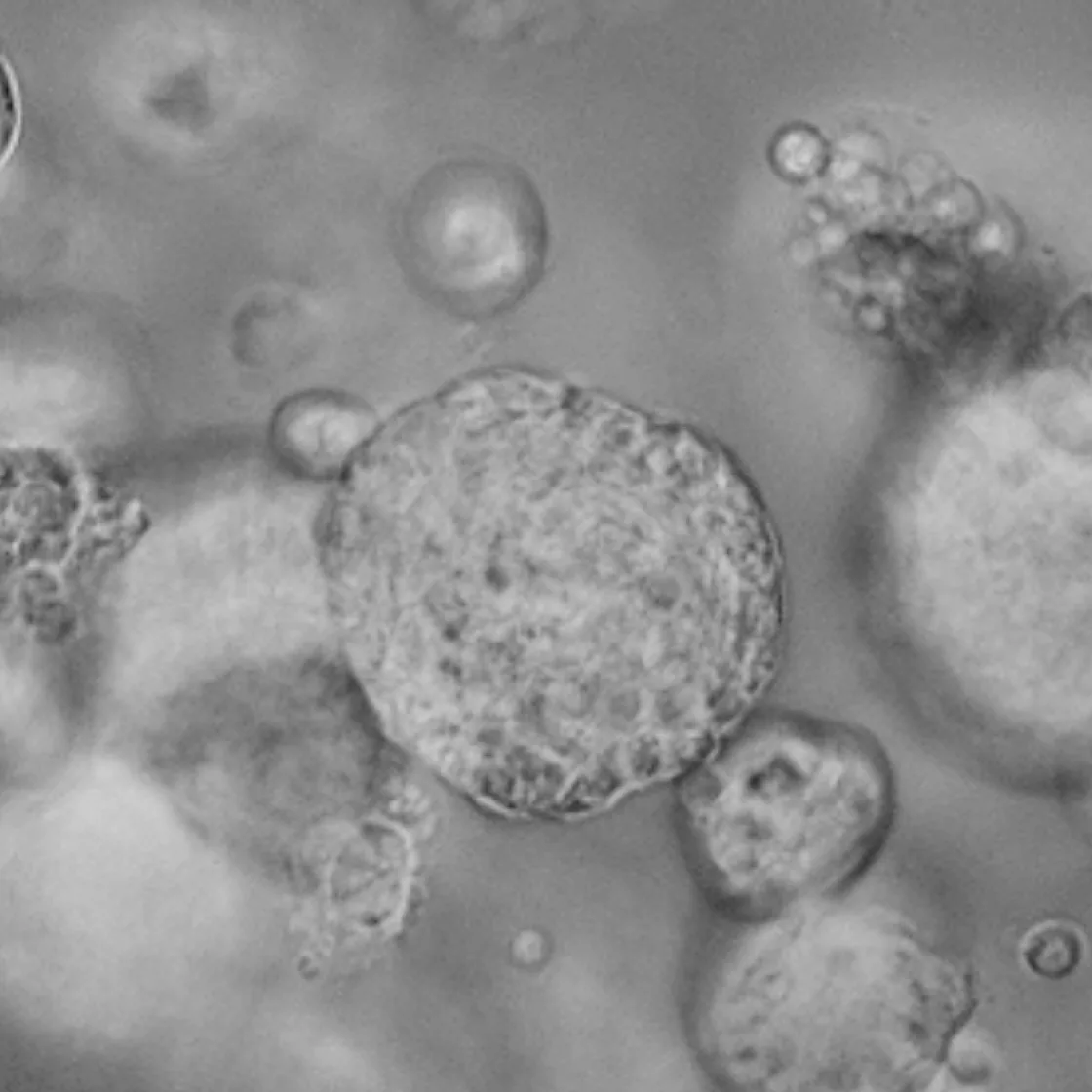 Lacrimal Gland Organoid_main