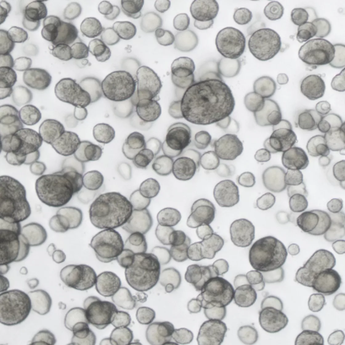 Non-Small Cell Lung Cancer Organoid_main