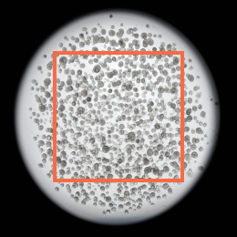 Lung cancer organoid_01_02